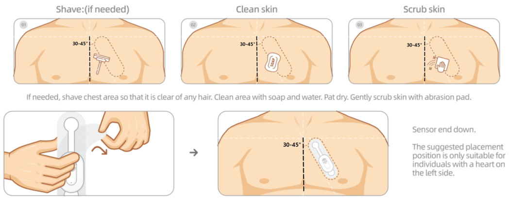 Patch Position Guide